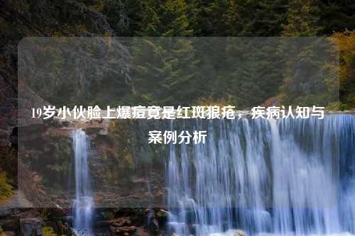 19岁小伙脸上爆痘竟是红斑狼疮，疾病认知与案例分析